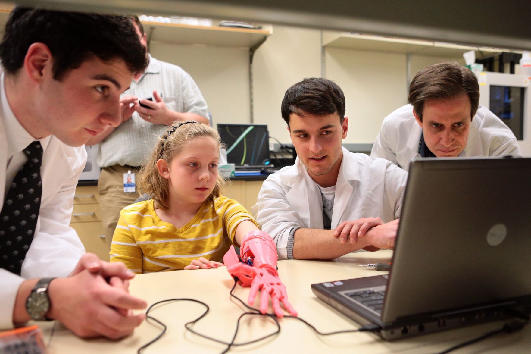 Kids test lower cost and lighter weight prostheses made by 3D printers in new study at Children's Hospital